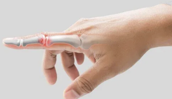 Parmak Eklem Hasarı