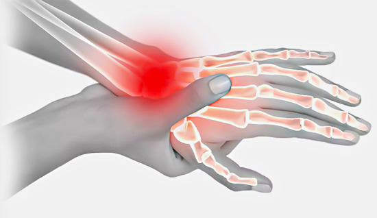 Skafoid Kırıkları